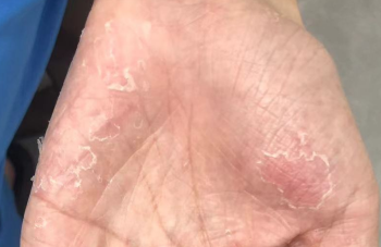 手足“小烦恼”别忽视，科学预防是关键！